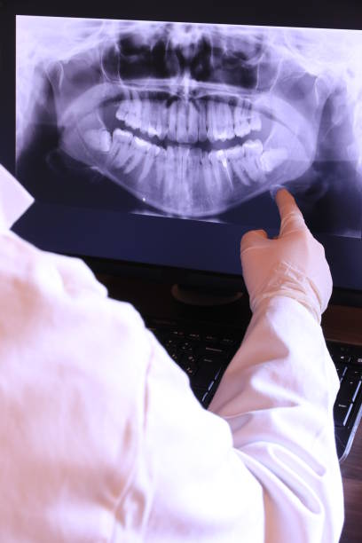 Best Emergency Root Canal Treatment in Stanleytown, VA