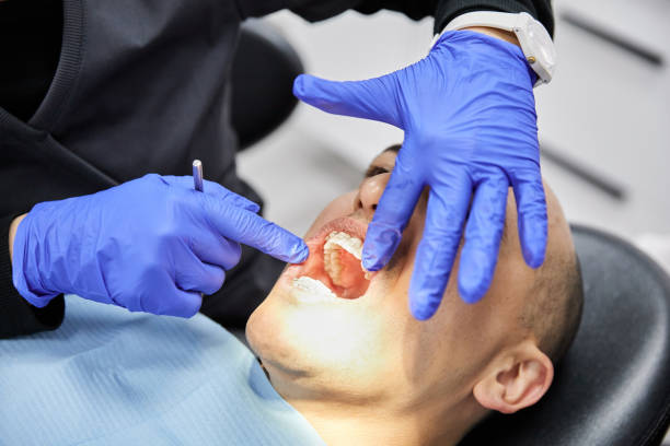 Best Emergency Wisdom Teeth Removal in Stanleytown, VA