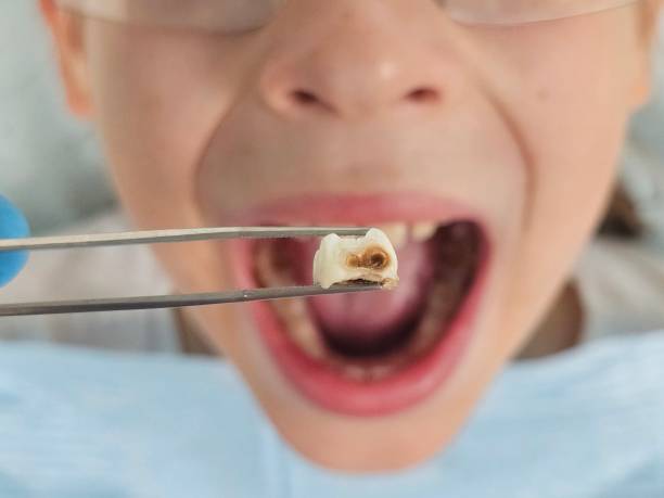 Best After-Hours Emergency Dentist in Stanleytown, VA