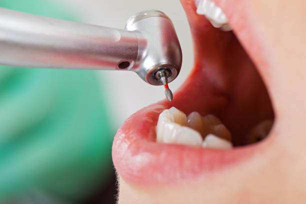 Best Walk-In Emergency Dentist in Stanleytown, VA